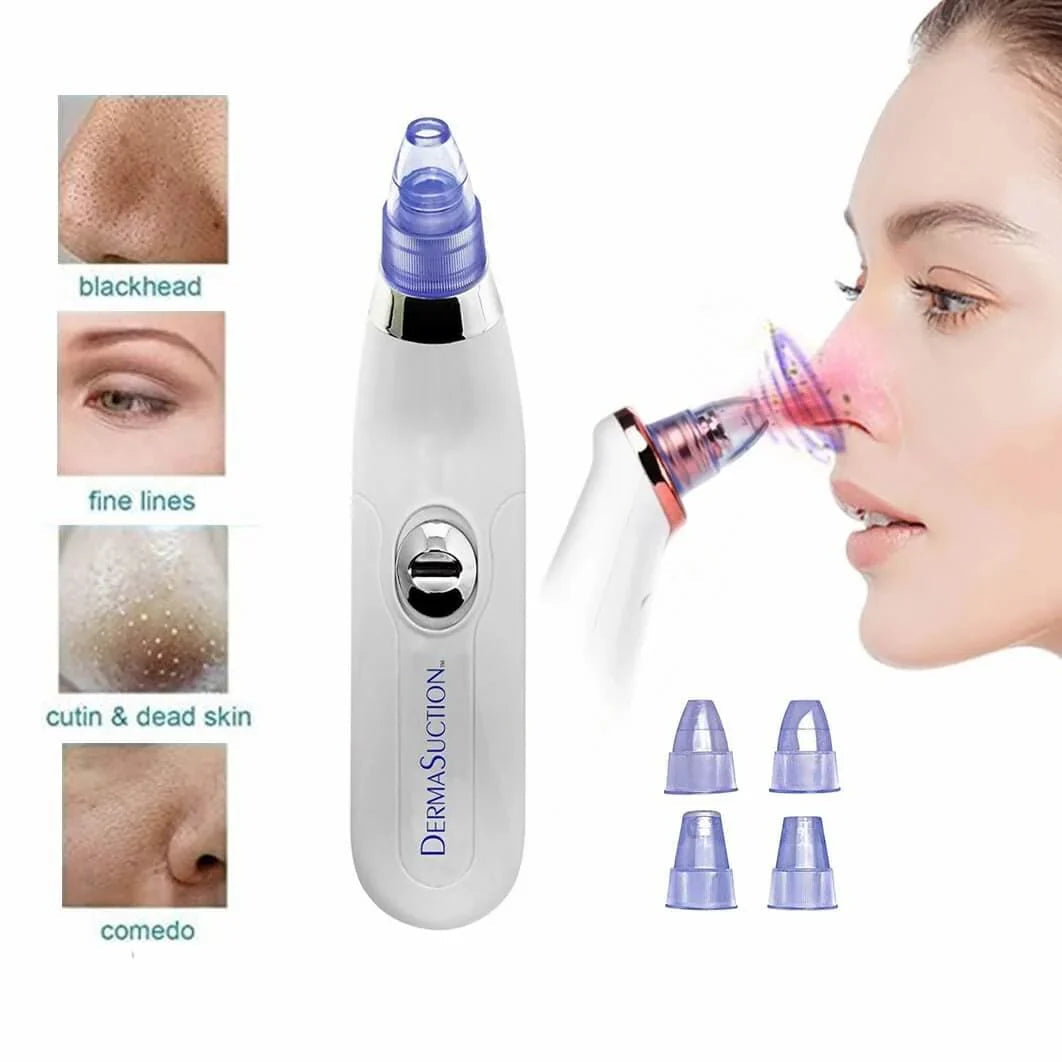 5-in-1 Acne & Blackhead Remover Pro ⭐
