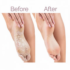 Electric Pedicure Foot File Callus Remover (مبرد كهربائي للقدمين لإزالة الجلد الميت والكالو)